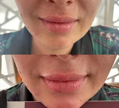 Dr. Armine - Glendale, CA, USA - $ undefined